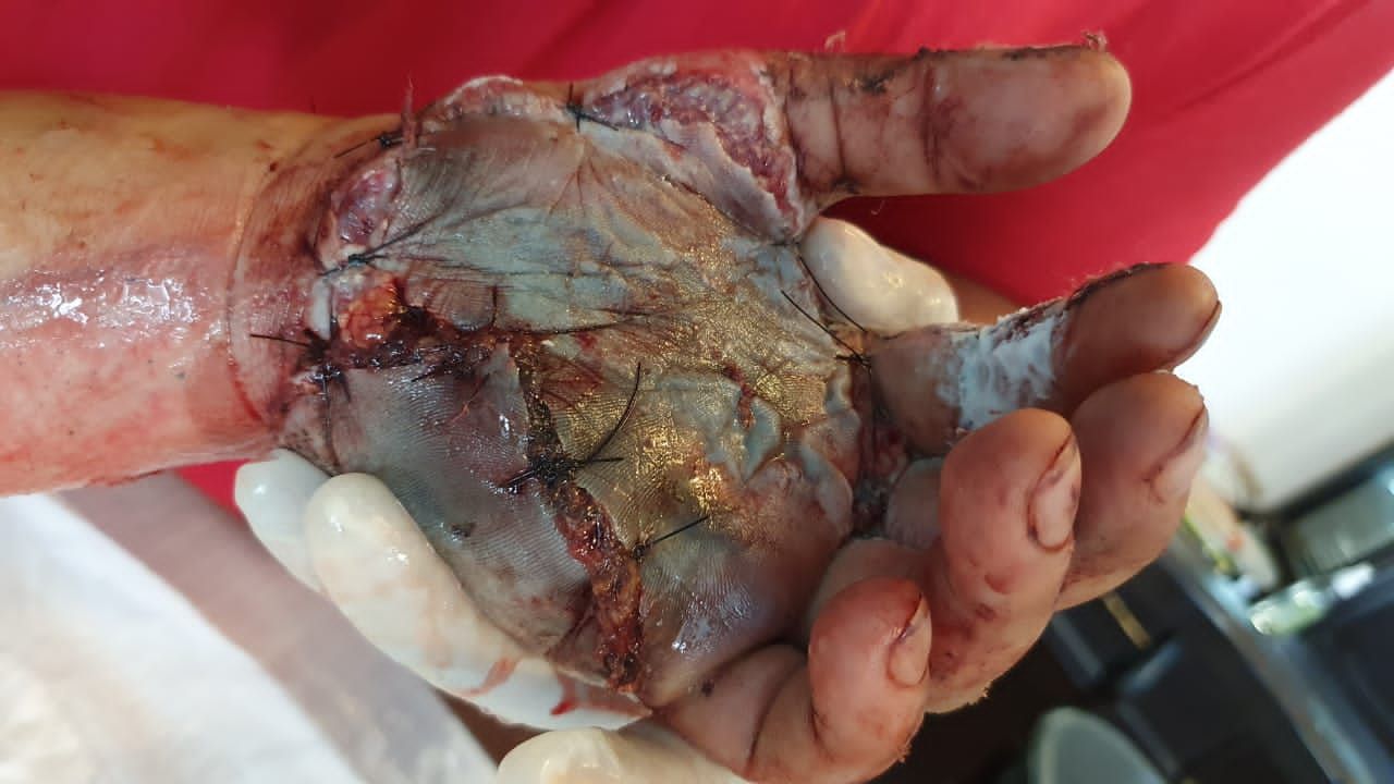 Federico Quintana De La Rosa-43