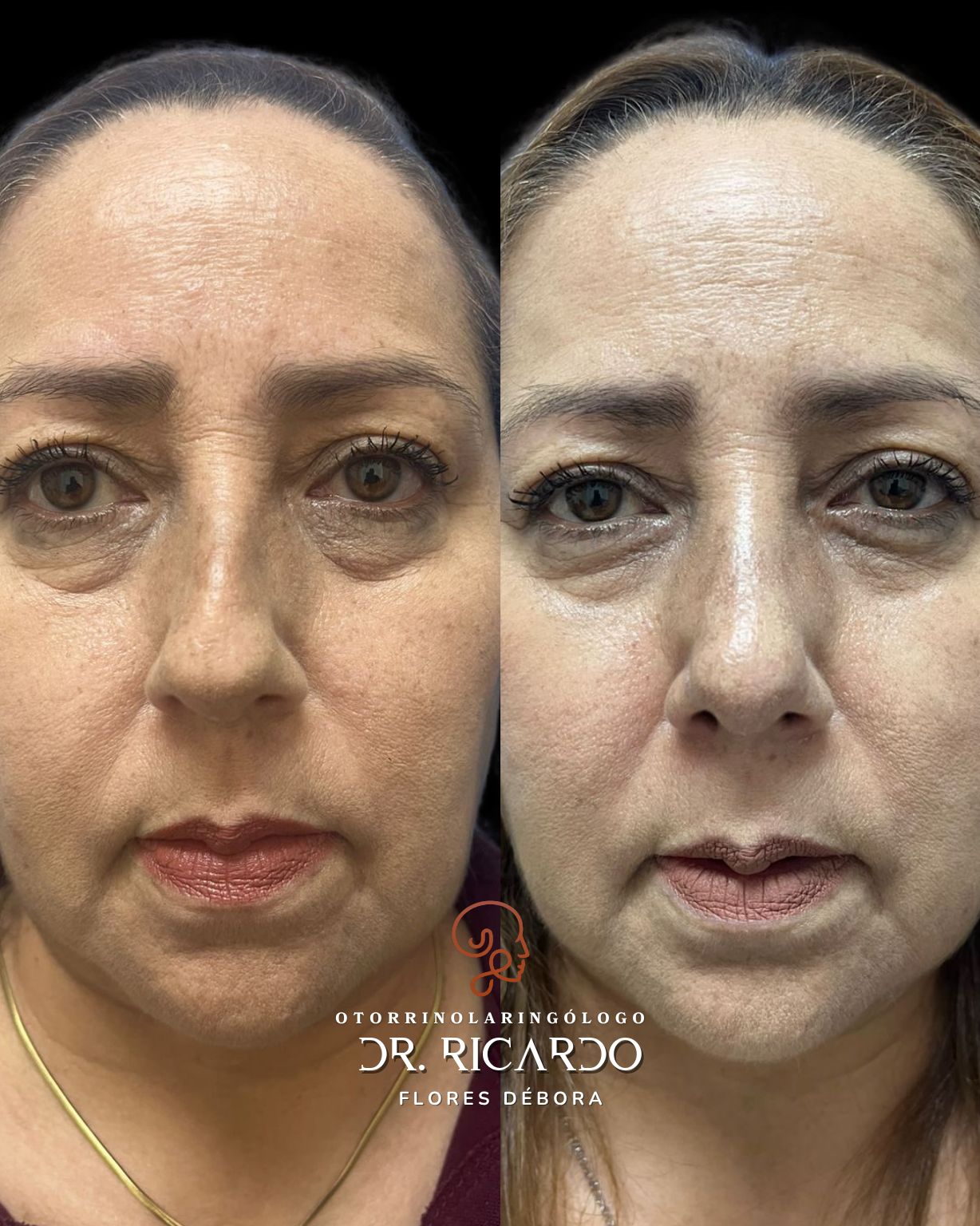 Ricardo Flores Débora-4