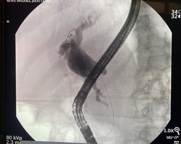 J. César Reyes Vásquez-18