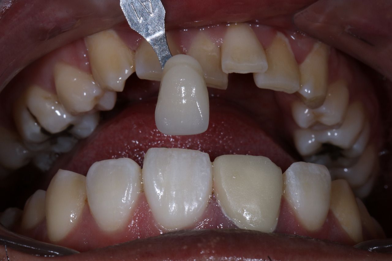 Raúl Méndez Cifuentes-20