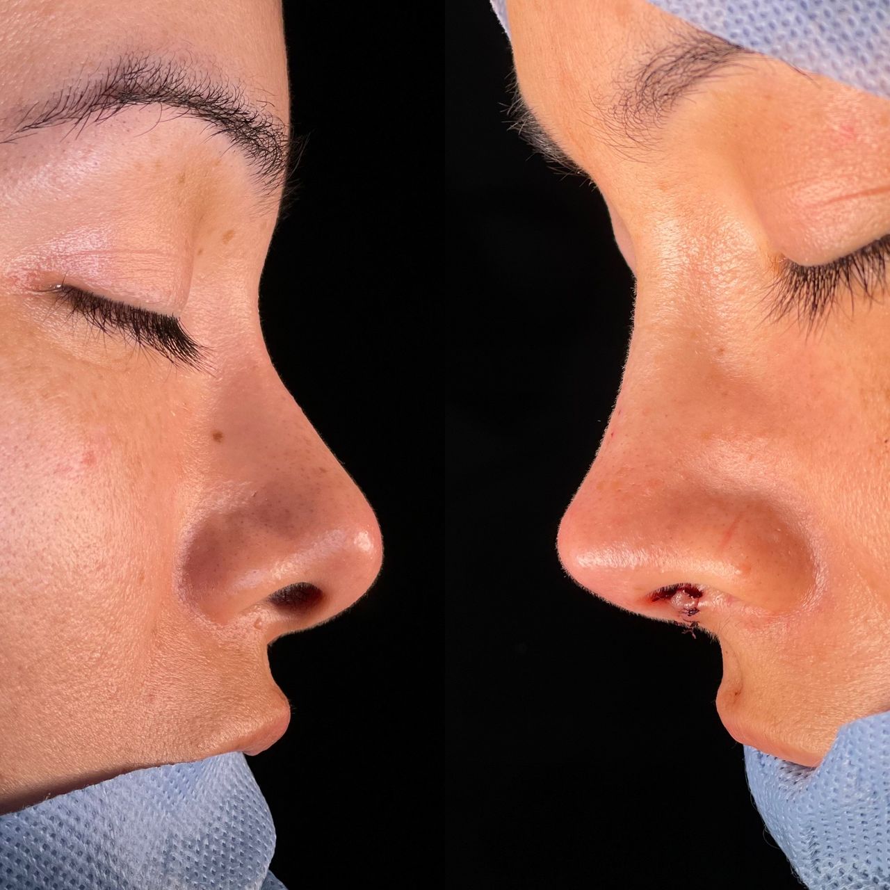 Angel Castro Urquizo-167