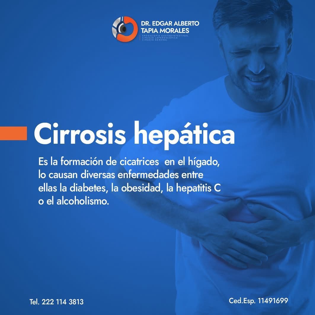 Edgar Alberto Tapia Morales-23