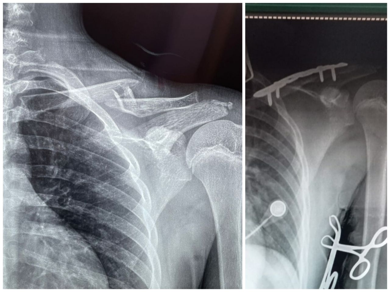 Gabriel De Leon Ochoa Lara-18