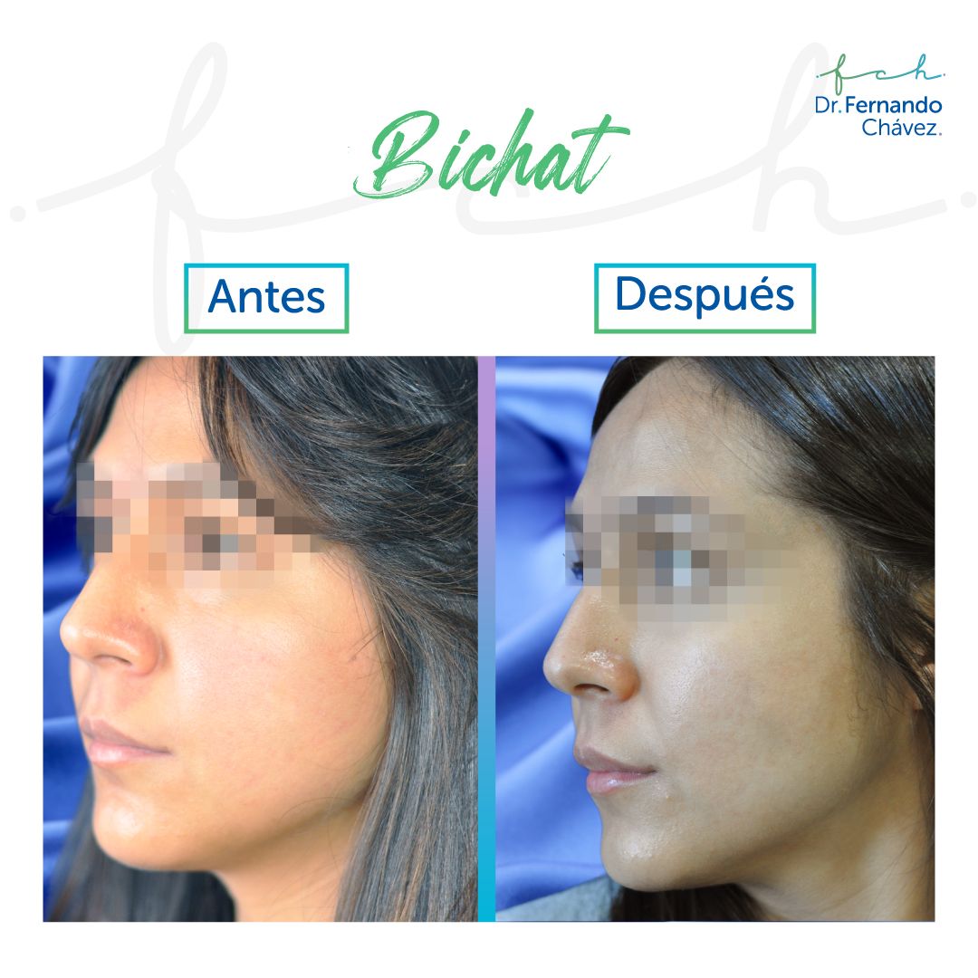 Fernando Chávez Osorio-26