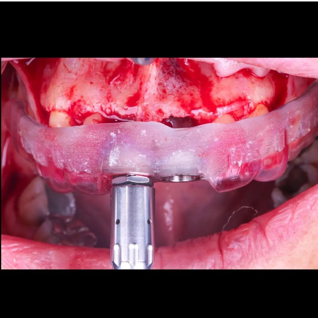 Hugo Enrique Aguilar Lamas-54