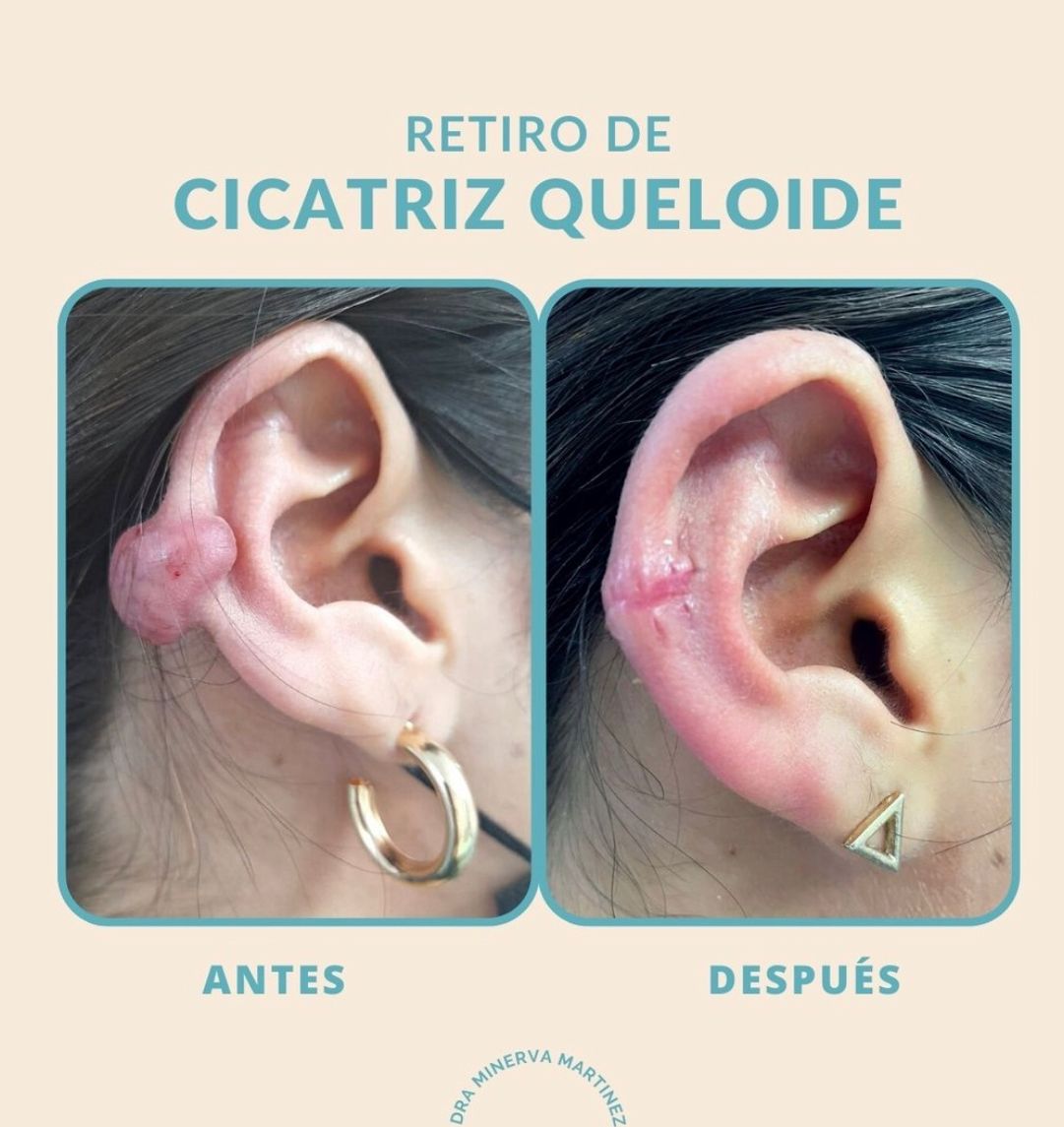 Yadira Minerva Martínez Ortiz-3