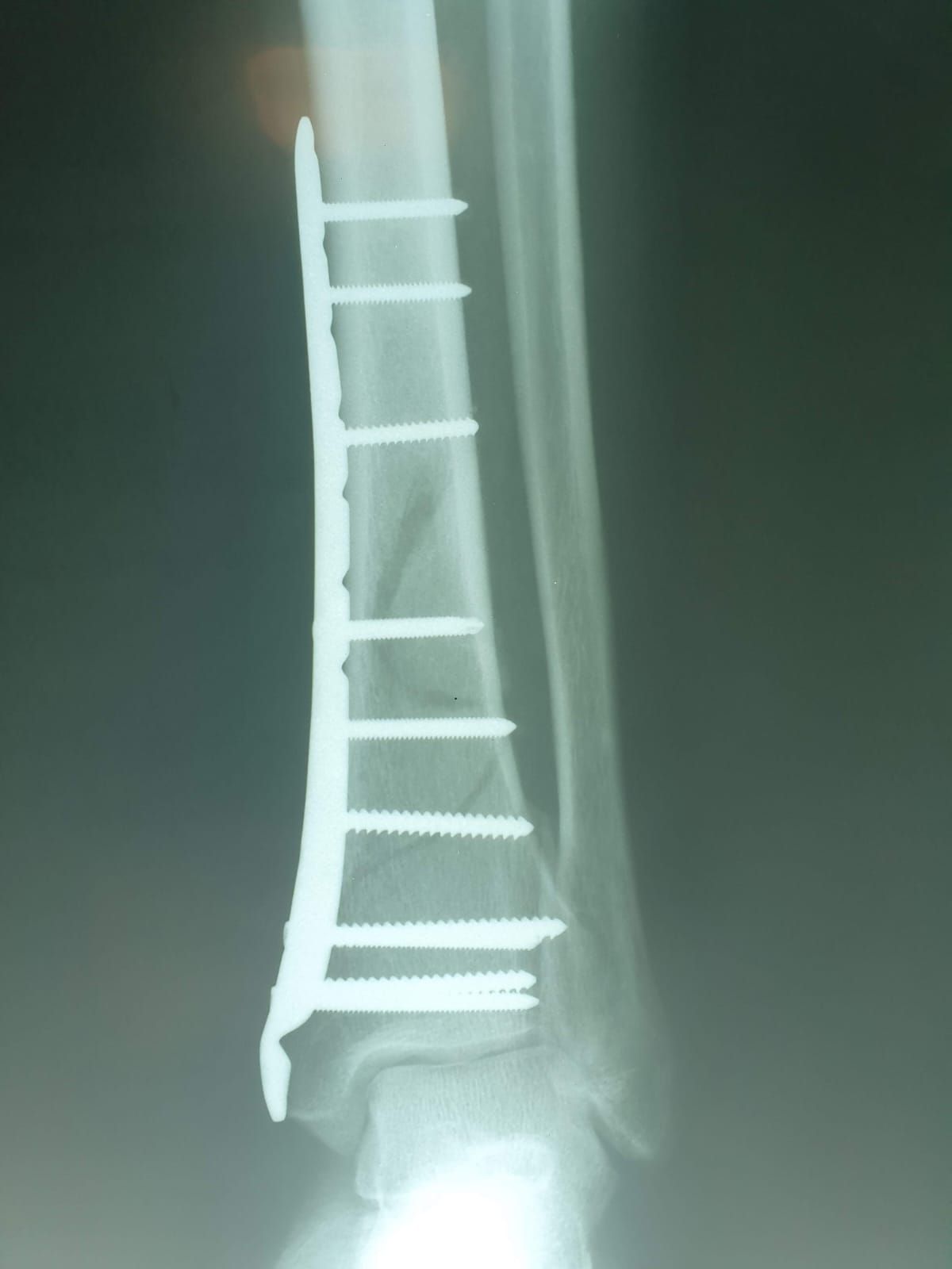 Ramon Garcia Acosta-7