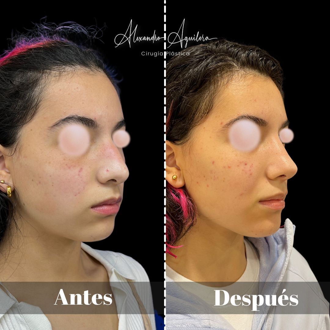 Alexandro Aguilera Salgado-36