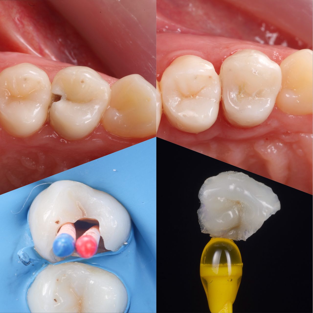 Hervin Eduardo Mendez Borrego-12