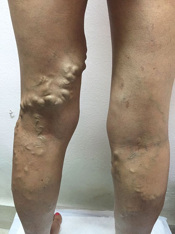 Erika Berenice Ramírez Pérez-2