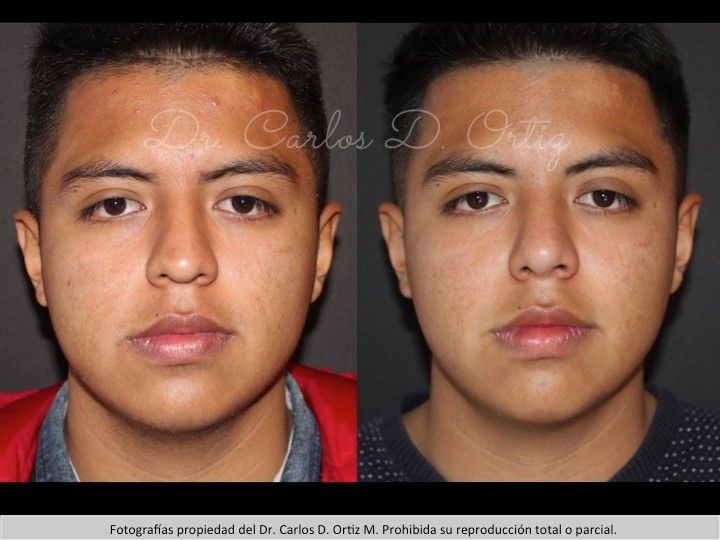 Carlos David Ortiz Moreno-8