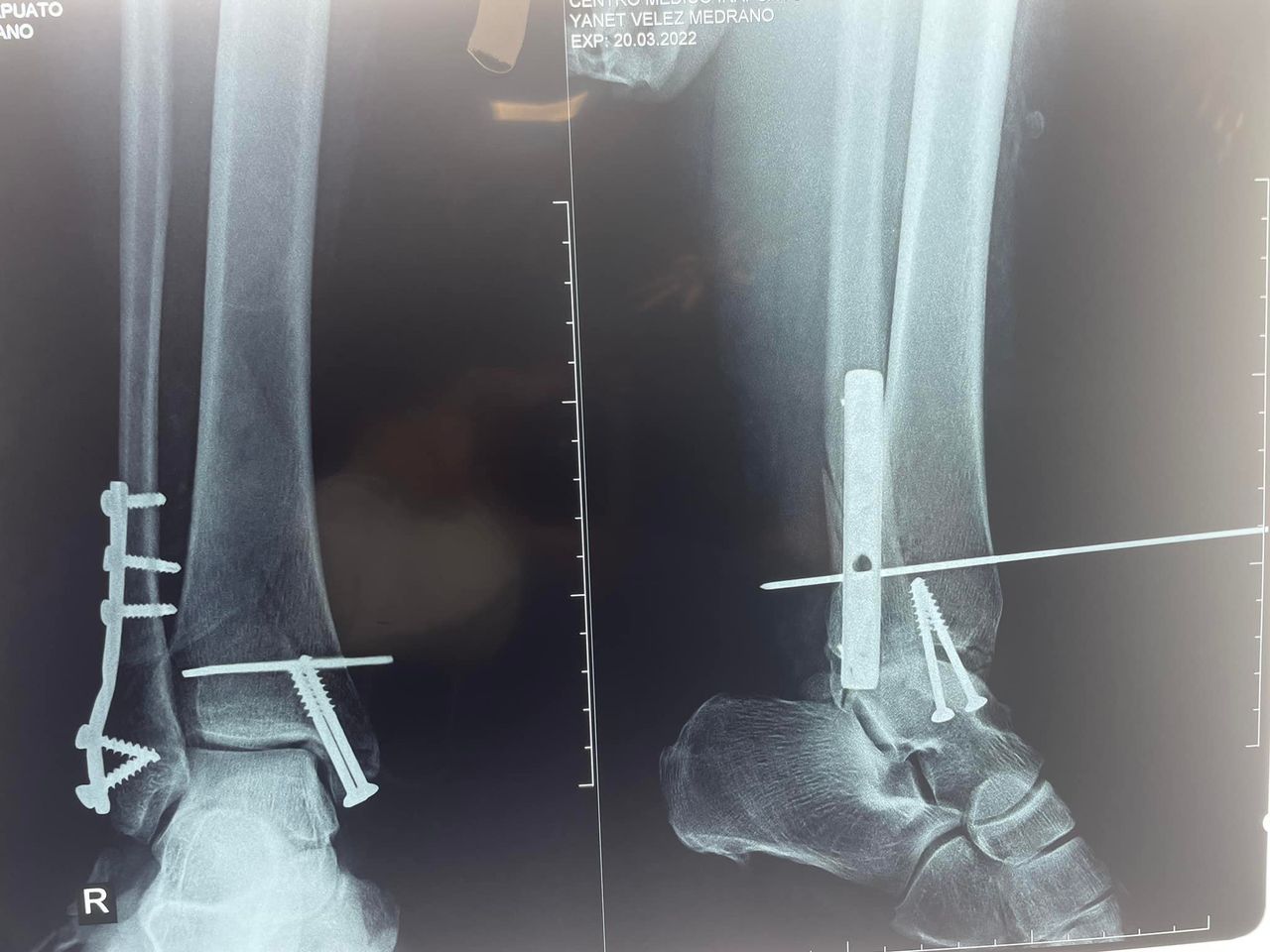 Felix Alfaro Arias-3