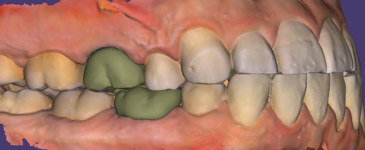 Jose David Torres Hernandez-25