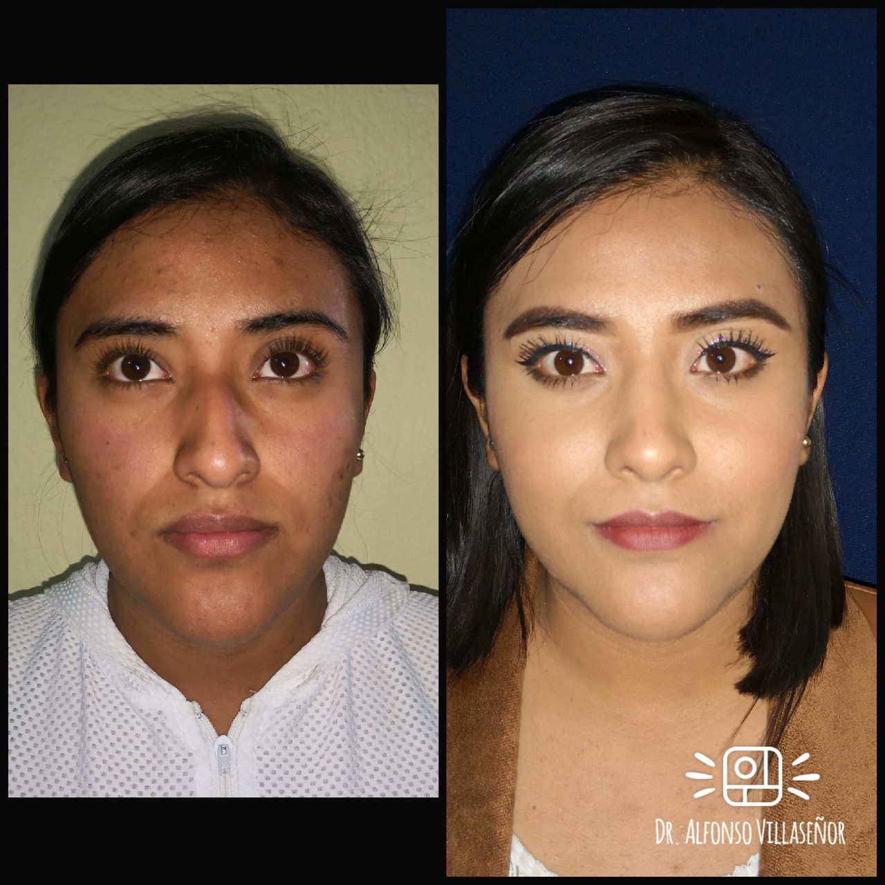 Alfonso Villaseñor Herrero-23