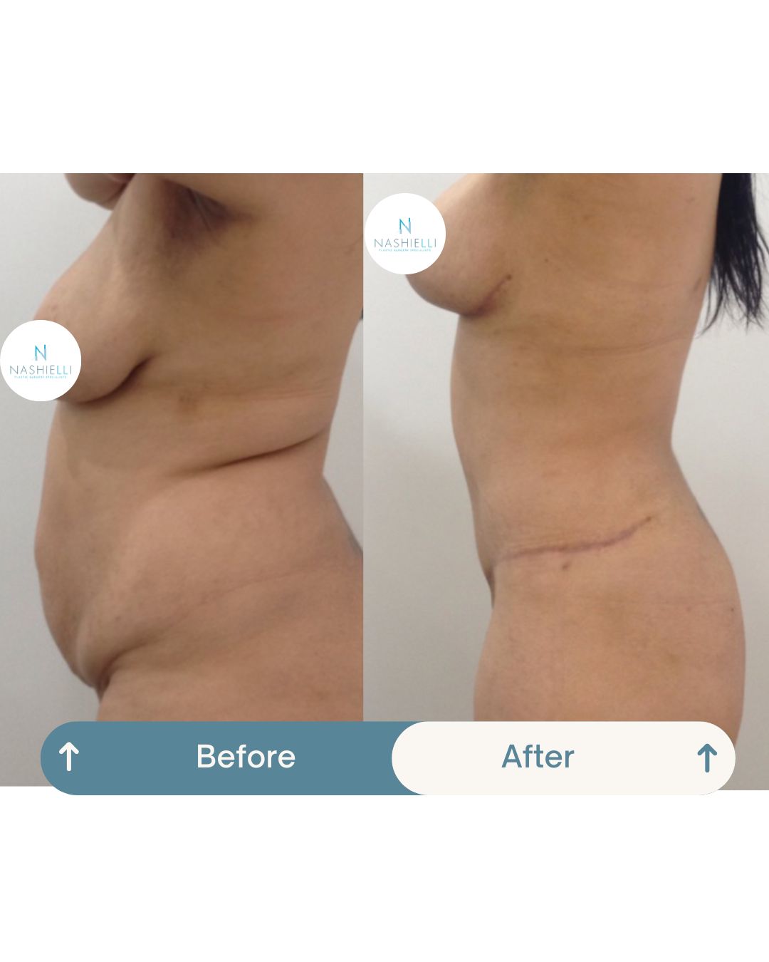 Nashielli Torres Espinosa Chiu-22