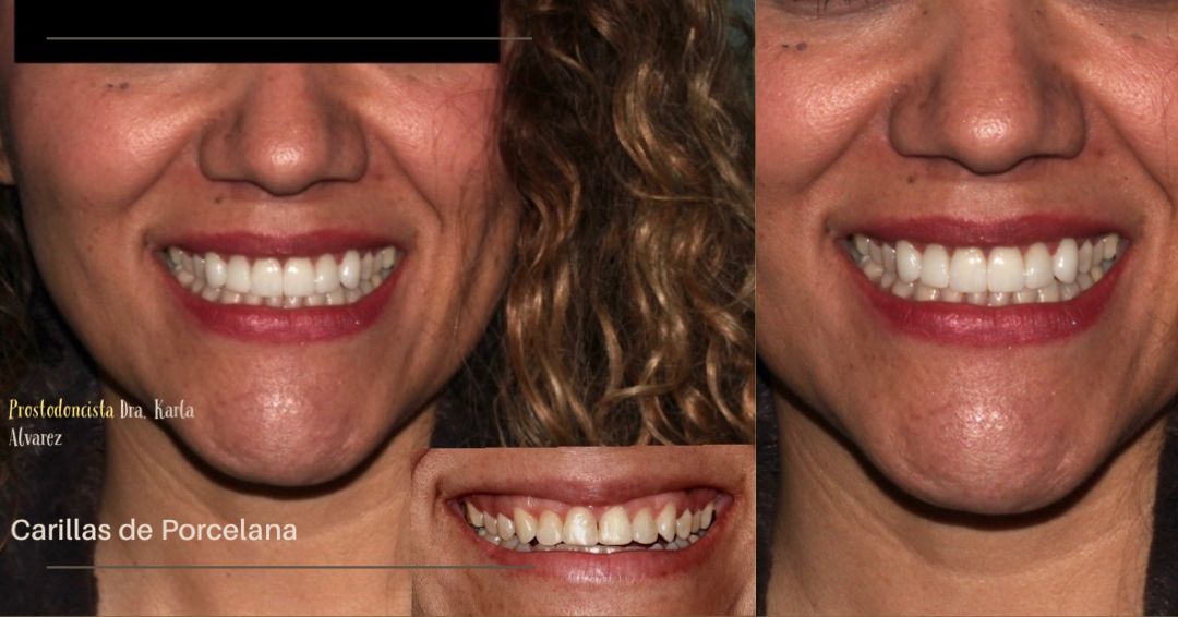 Karla Alvarez Treviño-5