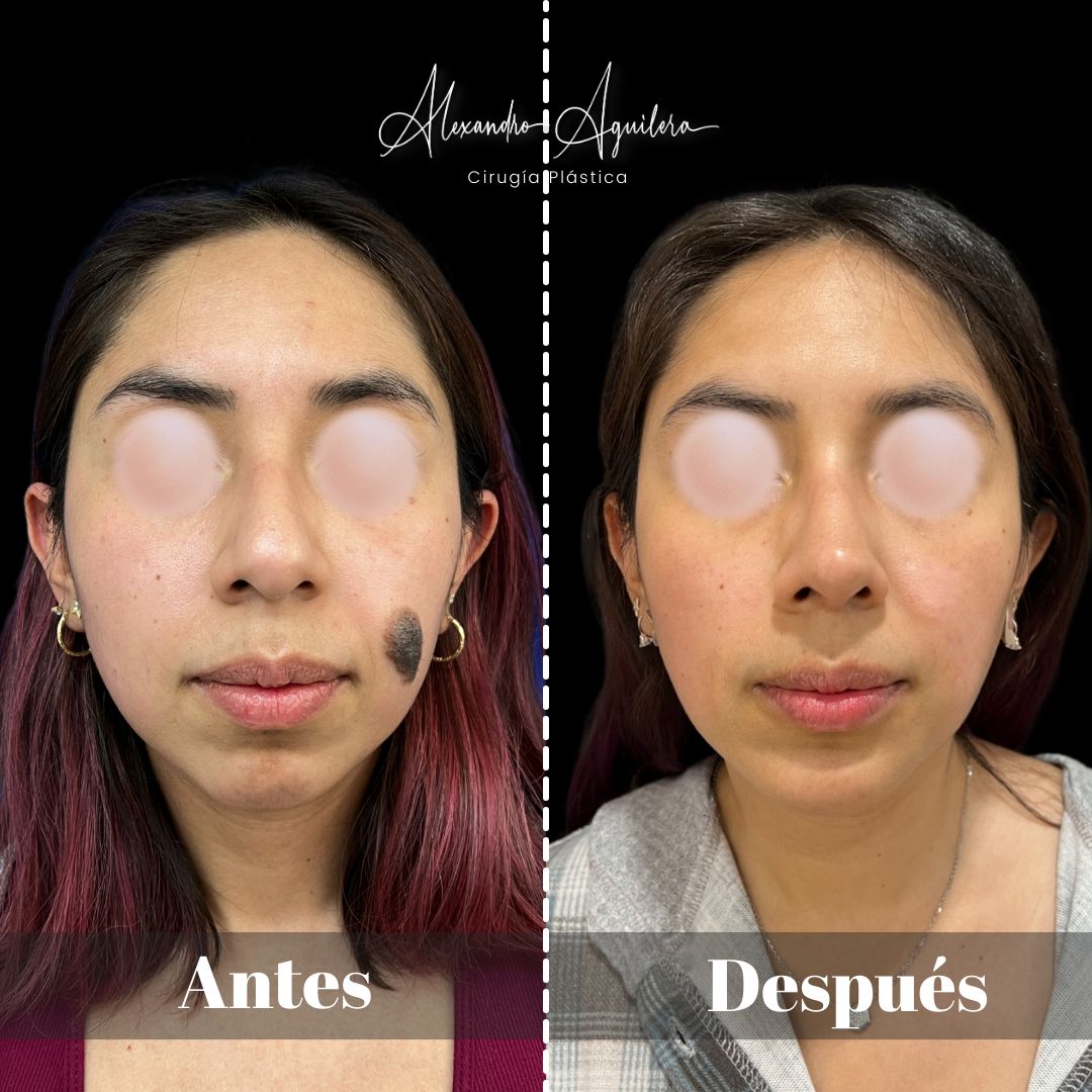 Alexandro Aguilera Salgado-32