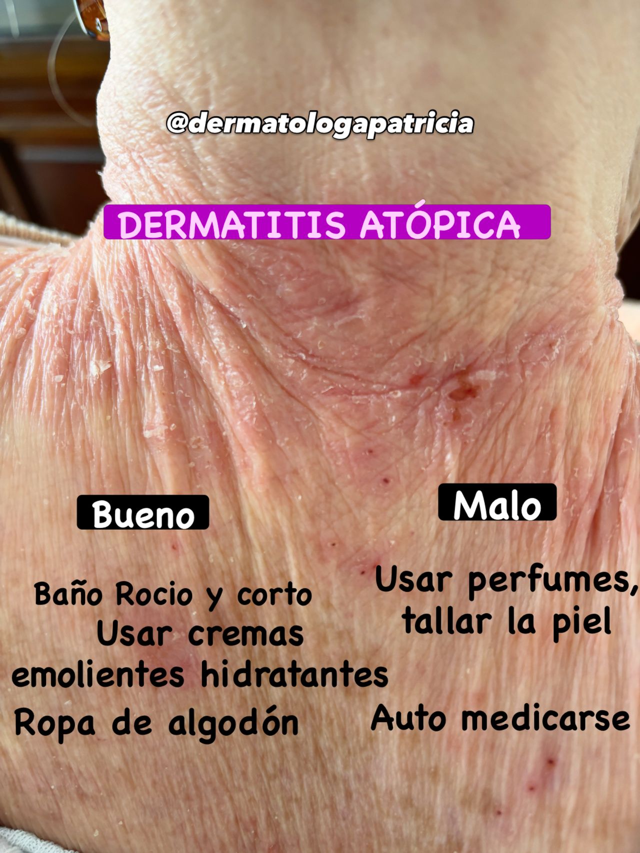 Patricia Alfaro Ledesma-16