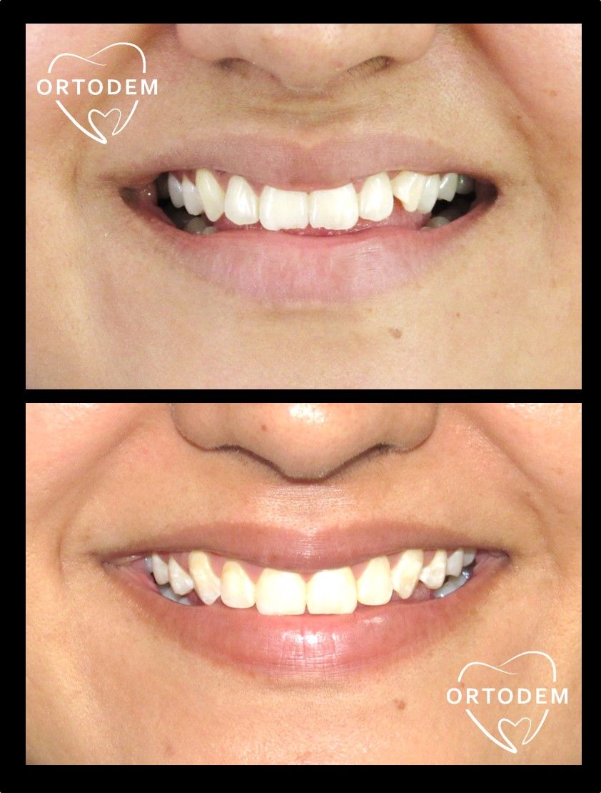 Elizabeth Morelos Morales-23