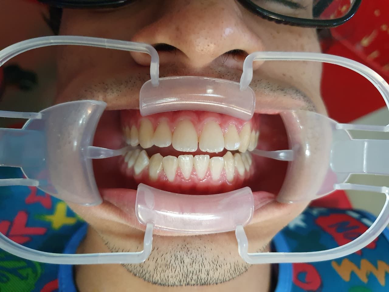 Fernando Olivier Victoriano-8