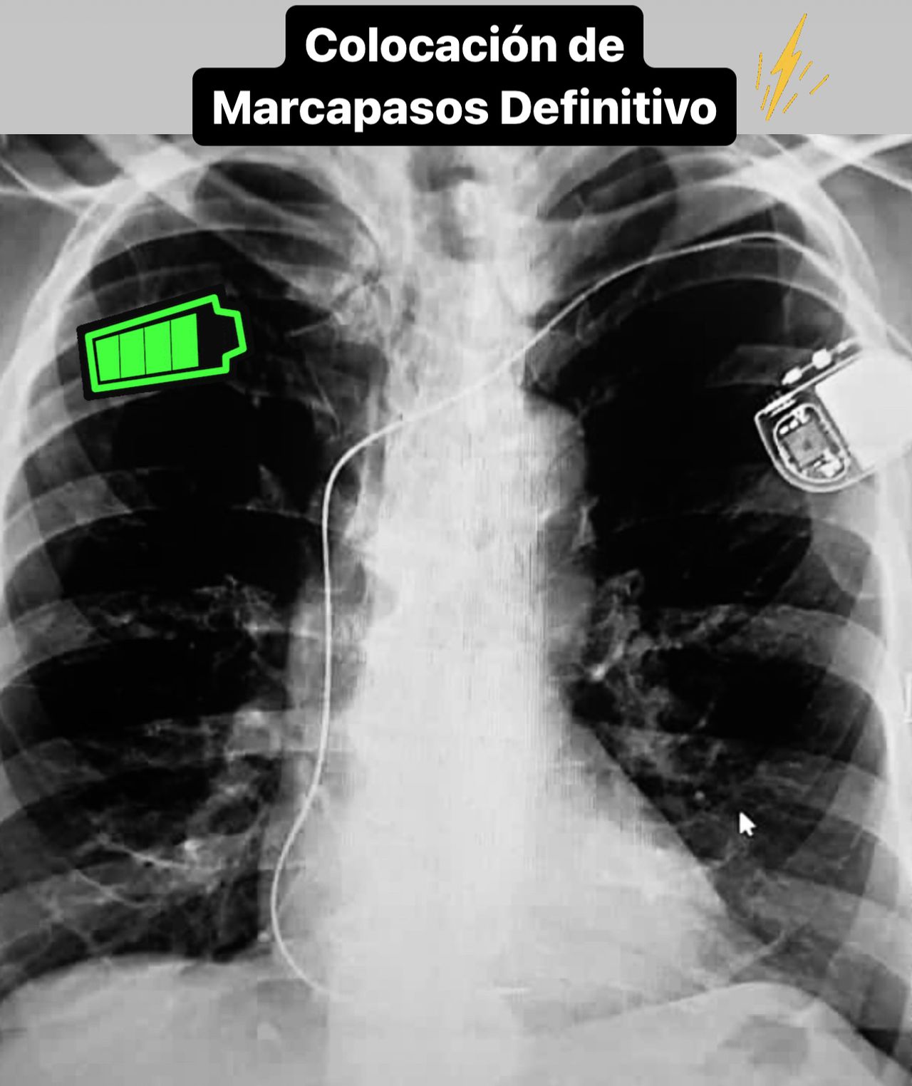 Abdón Ávila Chávez-22