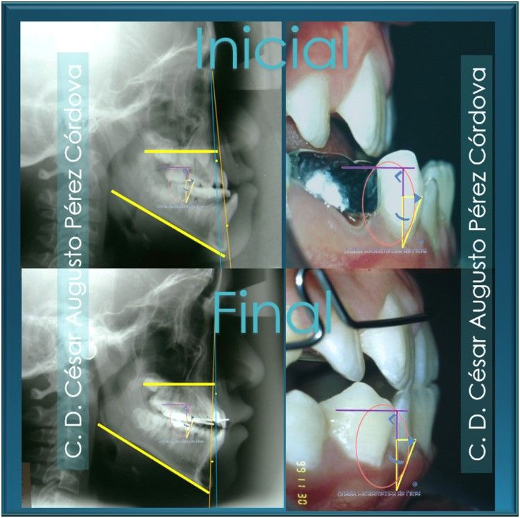 César Augusto Pérez Córdova-32