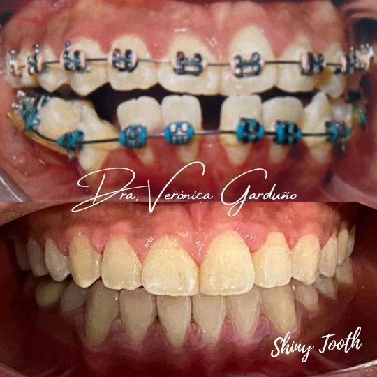 Nayeli Garcia Morales-18