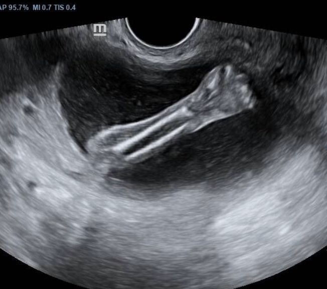 Nalliely Hernández Sebastian-4