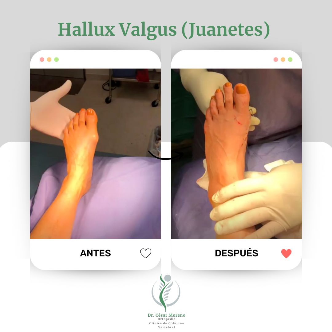 Cesar Alan Moreno Villegas-7