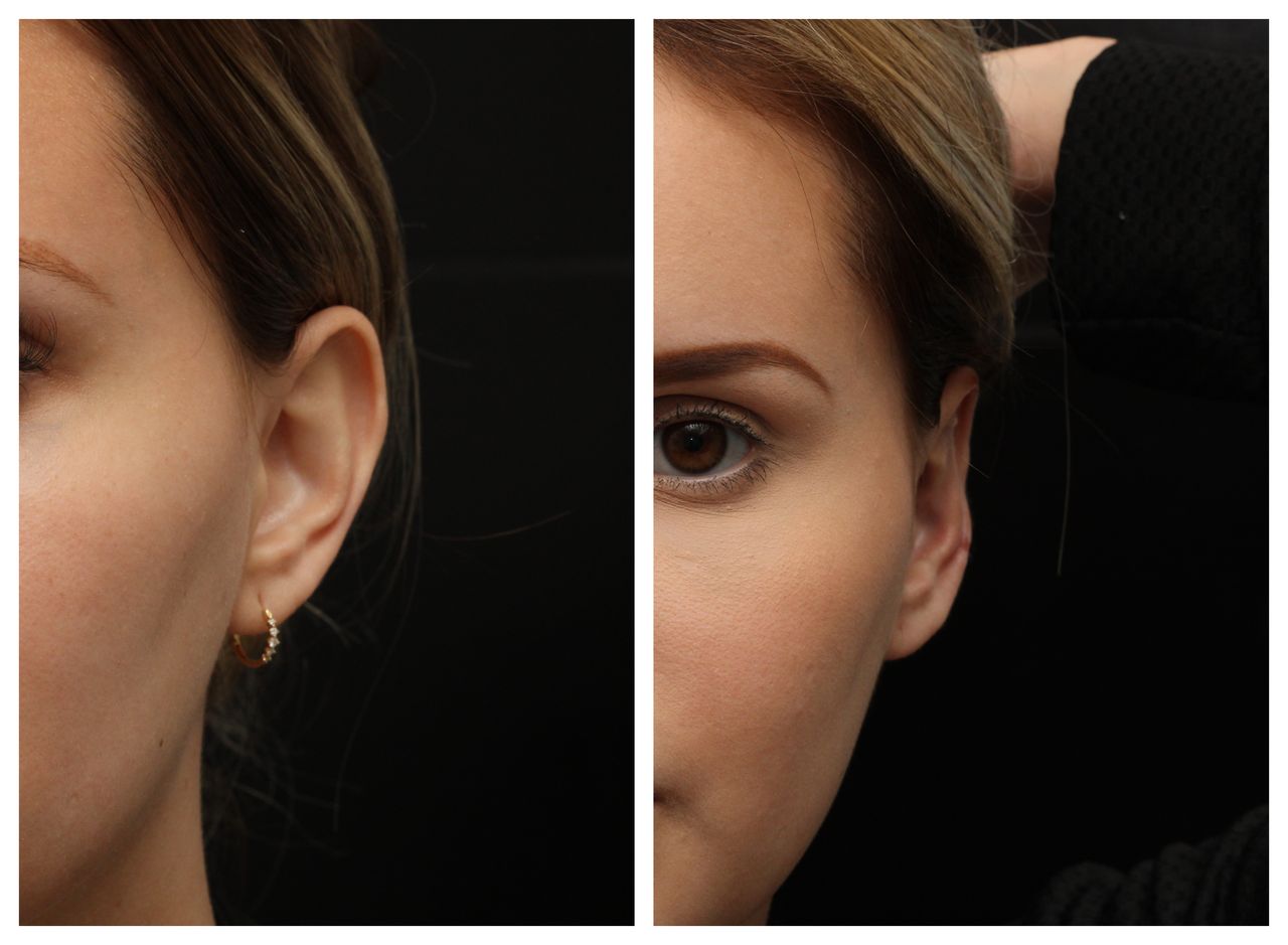 Angel Castro Urquizo-202