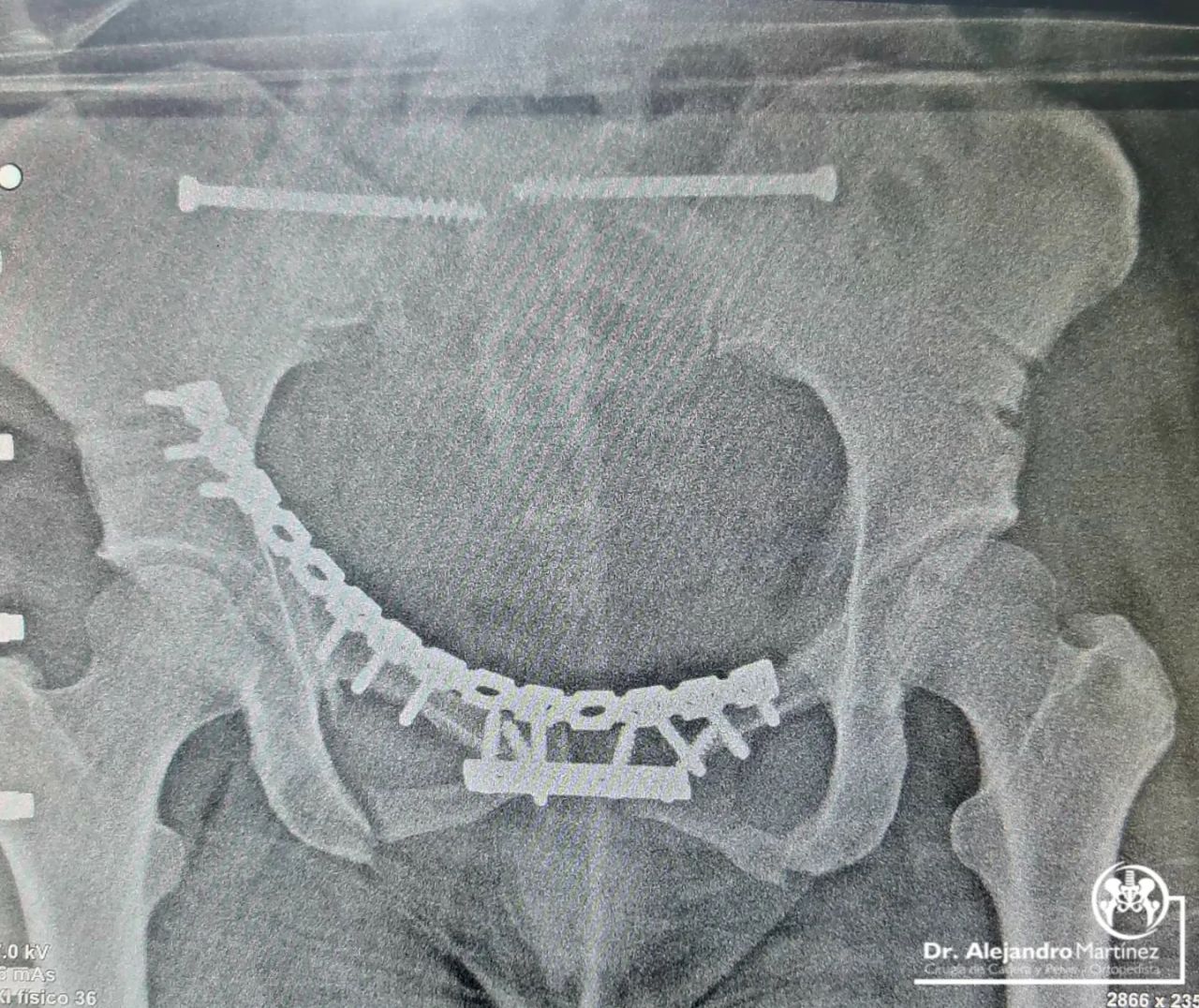 Alejandro Martínez Ramírez-19