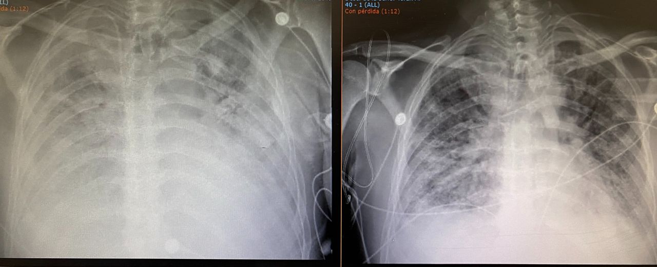 Jose Ivan Juarez Ramirez-0