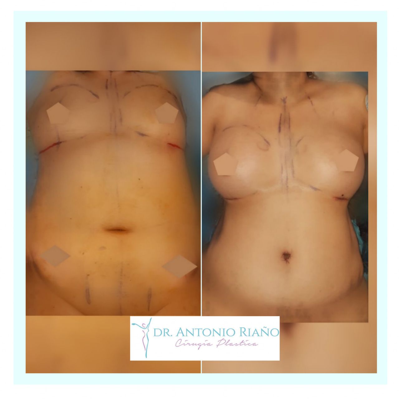 Jesús Antonio Riaño Rodríguez-3