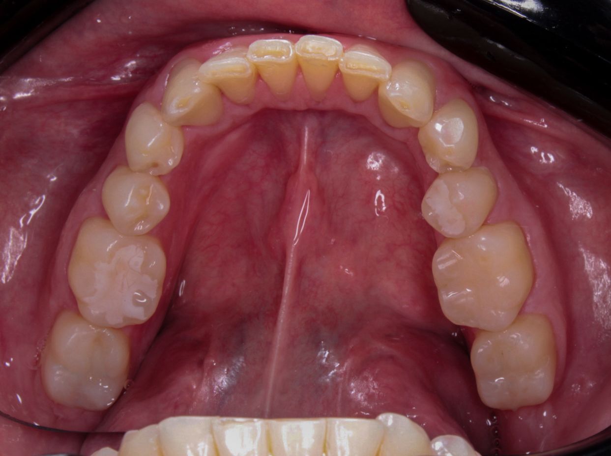 Anayansi Victoria Otero Guzmán-1