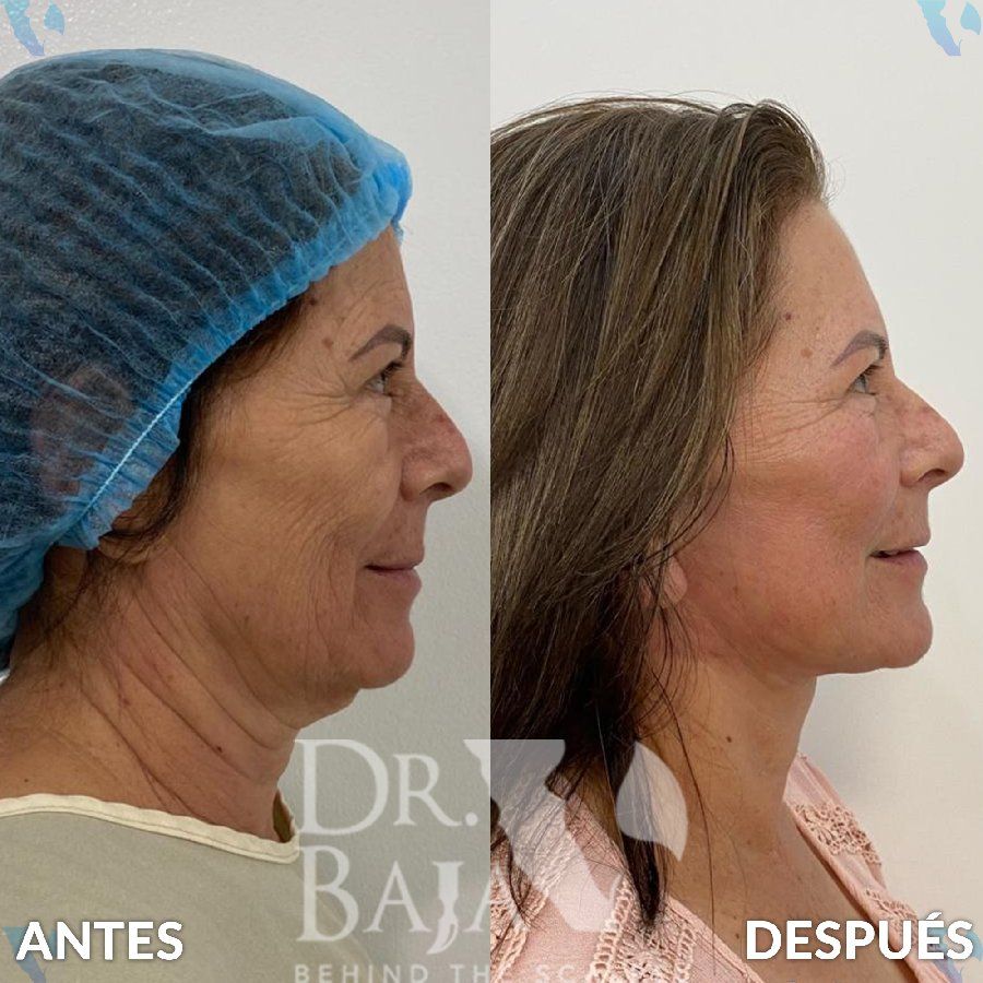 Renato Rodríguez Hirales-34