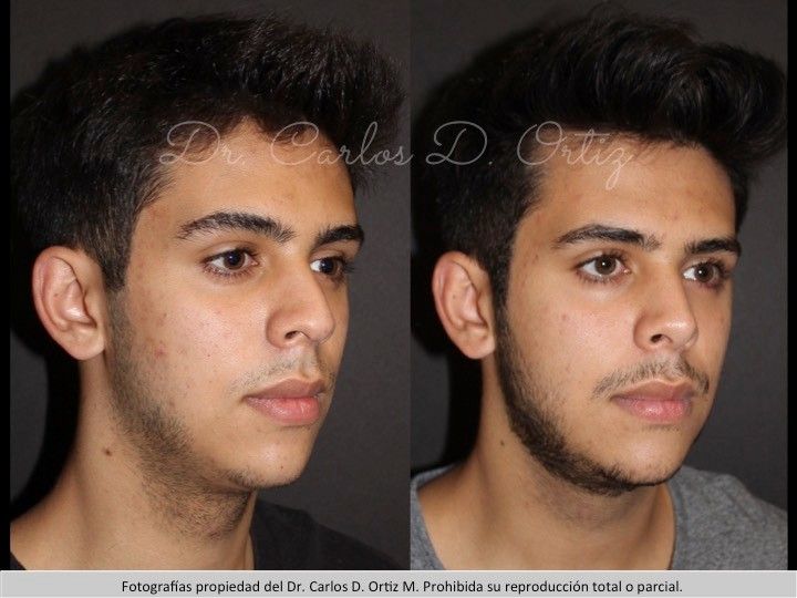 Carlos David Ortiz Moreno-15