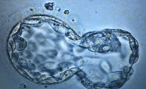 Pablo Joaquín Cervantes Mondragón-11