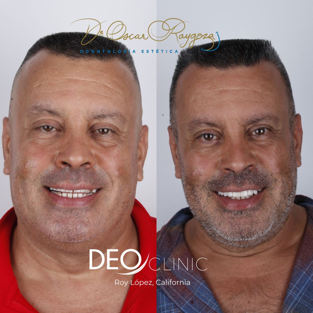 Oscar Raygoza Carrillo-32