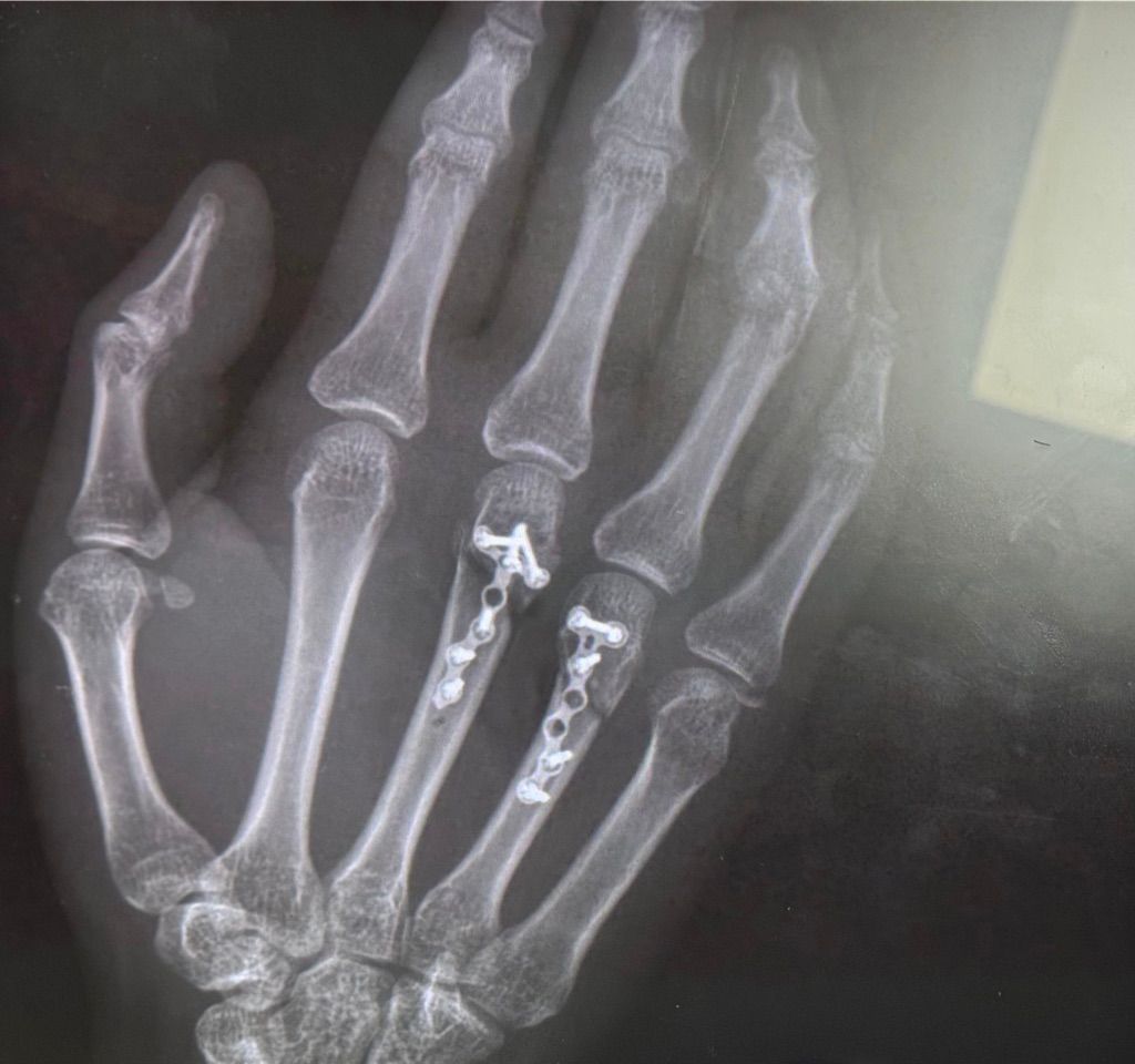 Gisela Cleto Zepeda-97