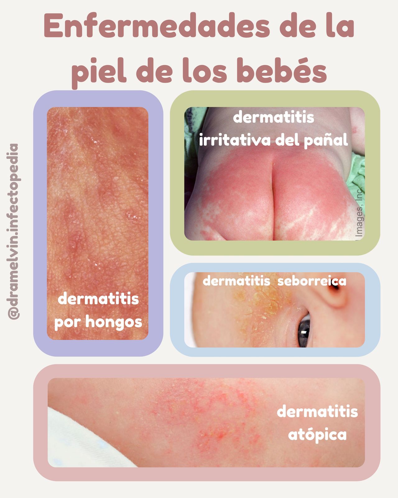 Melvin Alejandra Aguilar Molina-3