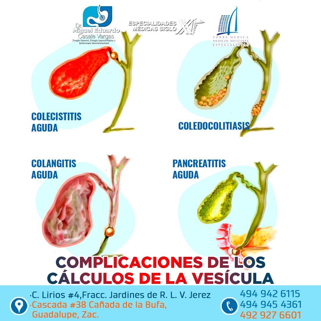 Miguel Eduardo Casale Vargas-13