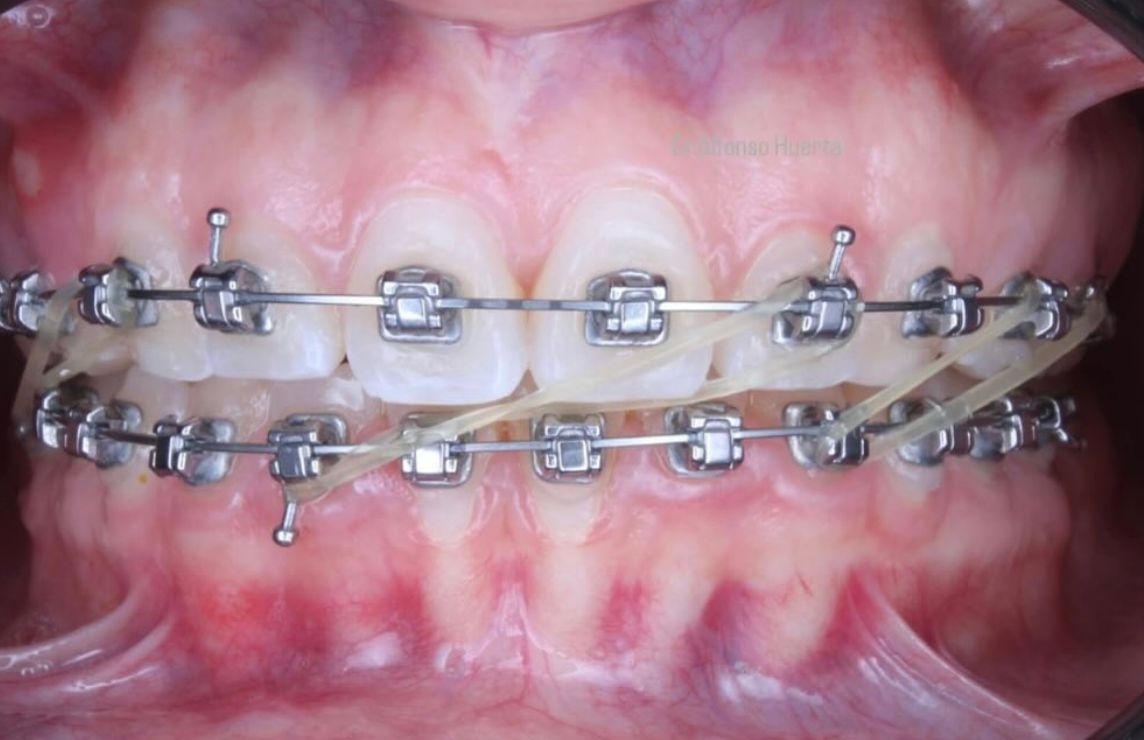 Alexa Costich González-6