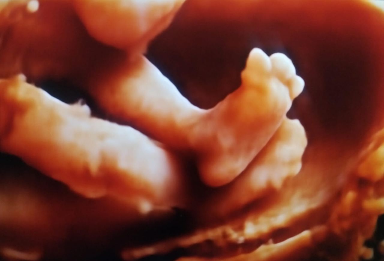 Iván André Guzmán Amador-3