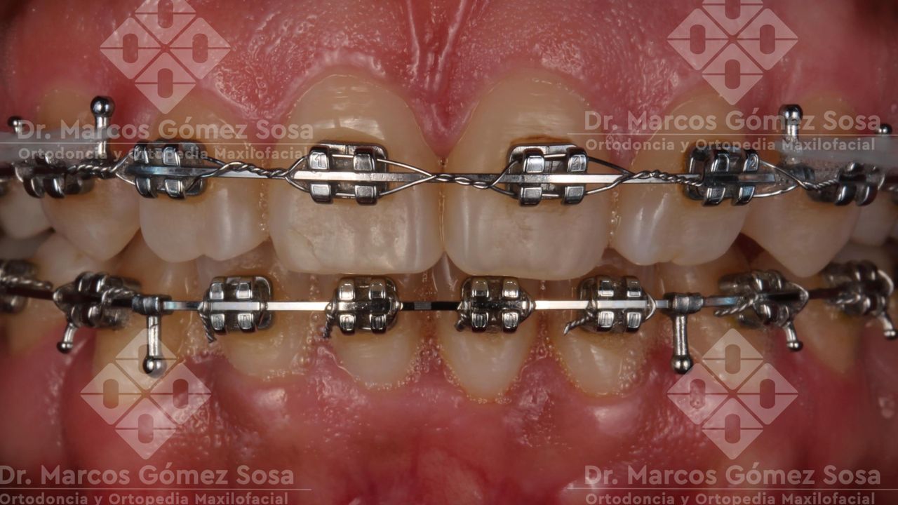 Marcos Gómez Sosa-5
