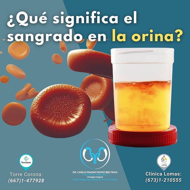 Carlo Magno Romo Beltran-1