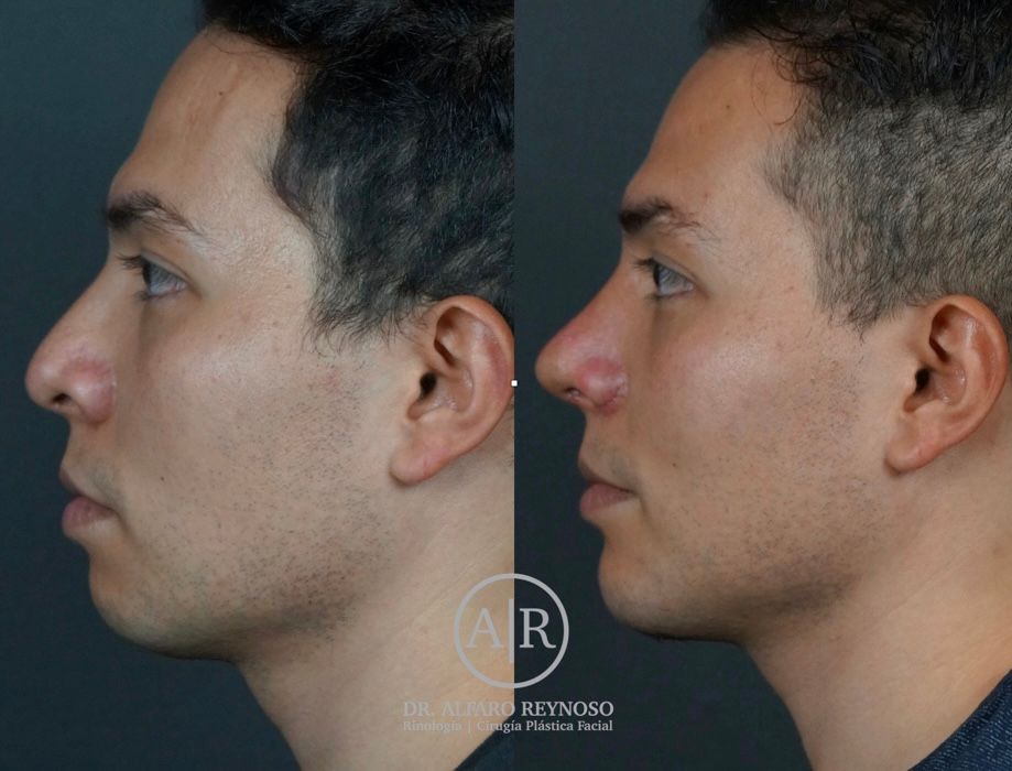 Jose Alberto Alfaro Reynoso-5