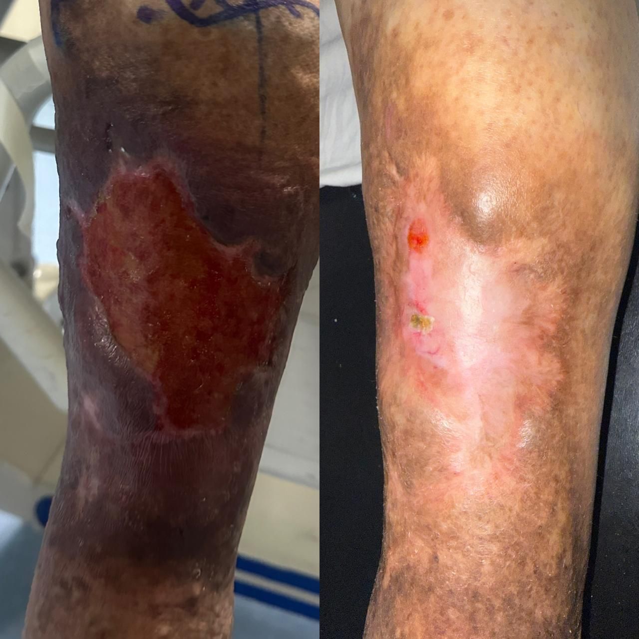 Jhonatan López González-15