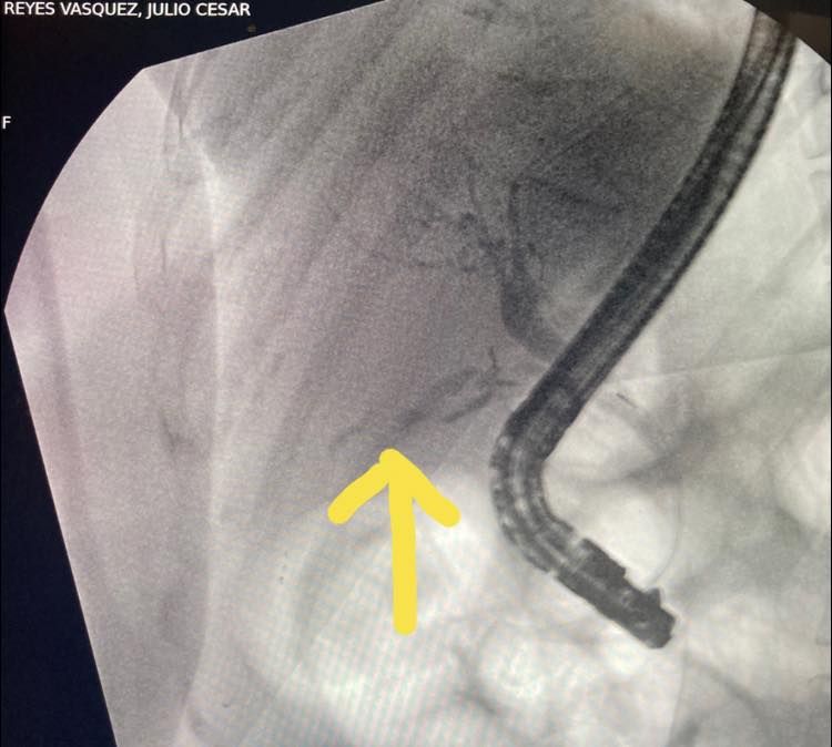 J. César Reyes Vásquez-20