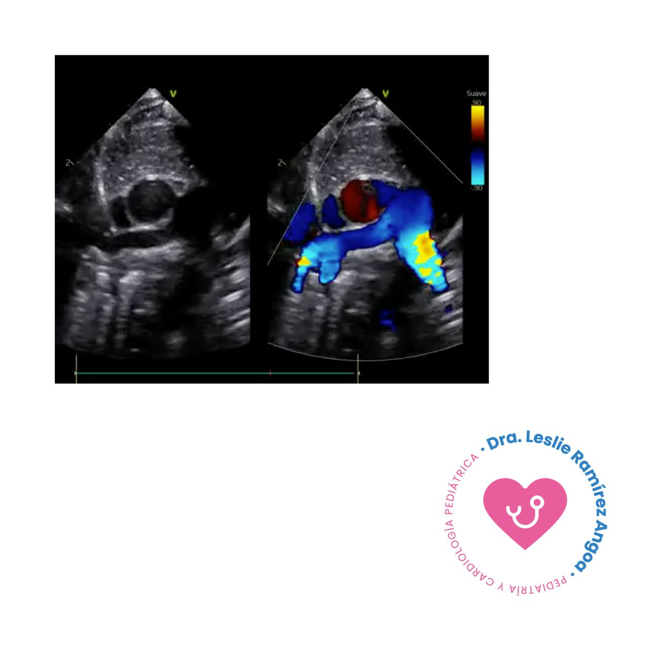 Leslie Ramirez Angoa-12