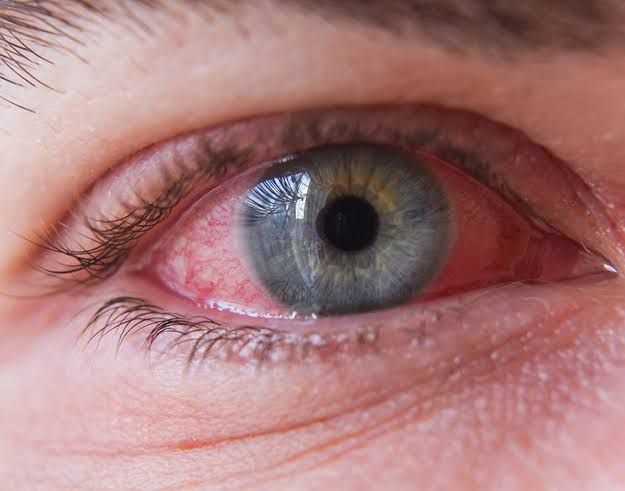 Álvaro Garza Arreola-10